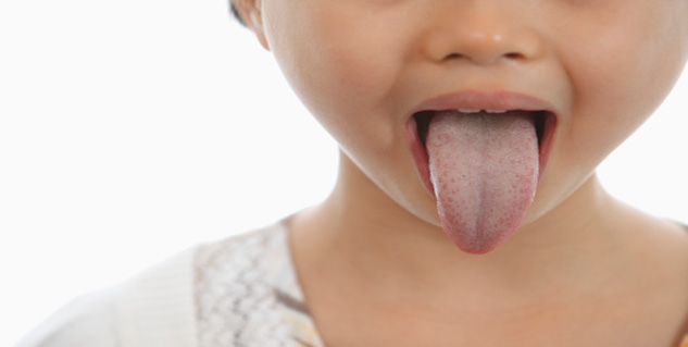 white coated tongue