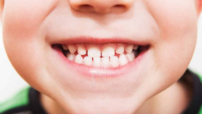 въпроси за детските зъби